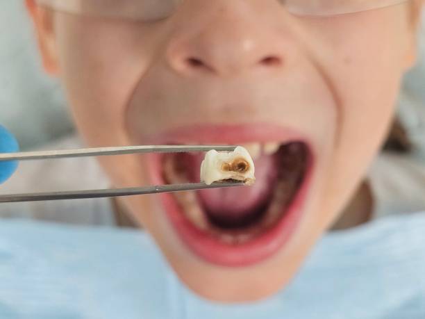Best Emergency Dentist for Kids  in Meriden, CT