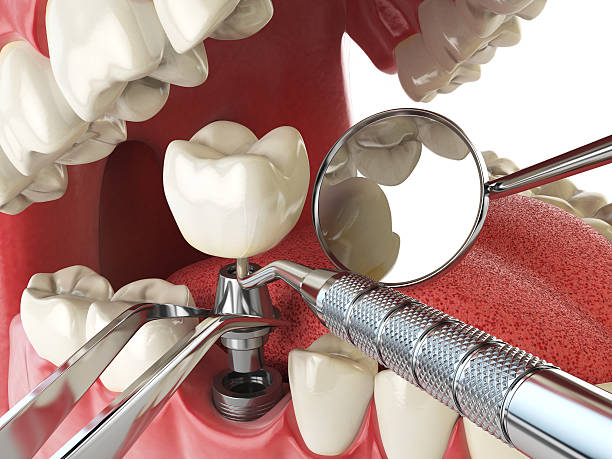 Best Cracked Tooth Emergency Dentist  in Meriden, CT